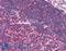 Unc-13 Homolog D antibody, LS-B1749, Lifespan Biosciences, Immunohistochemistry paraffin image 