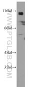Adducin 2 antibody, 14640-1-AP, Proteintech Group, Western Blot image 