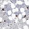 Integrin Subunit Alpha 2b antibody, NBP1-84579, Novus Biologicals, Immunohistochemistry frozen image 