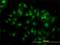 Tubulin Gamma 2 antibody, H00027175-M01, Novus Biologicals, Immunofluorescence image 