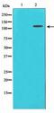 Interleukin 6 Signal Transducer antibody, LS-B16775, Lifespan Biosciences, Western Blot image 