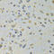 Aspartyl-TRNA Synthetase antibody, LS-C334805, Lifespan Biosciences, Immunohistochemistry frozen image 