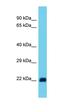 RAS Like Proto-Oncogene A antibody, orb330874, Biorbyt, Western Blot image 