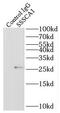 Zinc Ribbon Domain Containing 2 antibody, FNab08251, FineTest, Immunoprecipitation image 