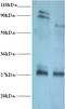 Thiopurine S-Methyltransferase antibody, LS-C211223, Lifespan Biosciences, Western Blot image 