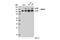 Adenosine Deaminase RNA Specific antibody, 14175S, Cell Signaling Technology, Western Blot image 