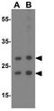 KIT Ligand antibody, GTX31379, GeneTex, Western Blot image 