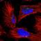 Alpha Kinase 1 antibody, NBP1-83594, Novus Biologicals, Immunofluorescence image 