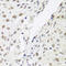 Chromobox 3 antibody, LS-C332014, Lifespan Biosciences, Immunohistochemistry paraffin image 