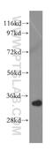 Ribosomal Protein L5 antibody, 15430-1-AP, Proteintech Group, Western Blot image 