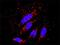 RAC-gamma serine/threonine-protein kinase antibody, H00010000-M08, Novus Biologicals, Proximity Ligation Assay image 