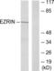 Ezrin antibody, LS-C118114, Lifespan Biosciences, Western Blot image 