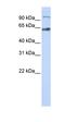 MAU2 Sister Chromatid Cohesion Factor antibody, orb325971, Biorbyt, Western Blot image 