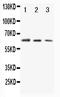 CD86 antibody, PA1394, Boster Biological Technology, Western Blot image 