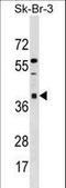 Armadillo Repeat Containing 10 antibody, LS-C159120, Lifespan Biosciences, Western Blot image 