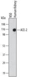 Angiotensin I Converting Enzyme 2 antibody, MAB9331, R&D Systems, Western Blot image 