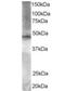 BRF2 RNA Polymerase III Transcription Initiation Factor Subunit antibody, orb18816, Biorbyt, Western Blot image 