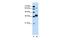 FOS Like 1, AP-1 Transcription Factor Subunit antibody, PA5-40361, Invitrogen Antibodies, Western Blot image 