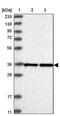 Exosome Component 7 antibody, PA5-57562, Invitrogen Antibodies, Western Blot image 