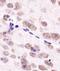 Aurora Kinase A antibody, NBP1-51843, Novus Biologicals, Immunohistochemistry paraffin image 