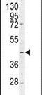 Trimethyllysine Hydroxylase, Epsilon antibody, PA5-24235, Invitrogen Antibodies, Western Blot image 