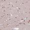 Transcription Factor AP-2 Delta antibody, HPA048962, Atlas Antibodies, Immunohistochemistry frozen image 