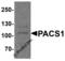 Phosphofurin Acidic Cluster Sorting Protein 1 antibody, 8187, ProSci Inc, Western Blot image 