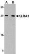 T-cell surface glycoprotein YE1/48 antibody, NBP1-76983, Novus Biologicals, Western Blot image 