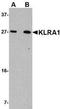 Ly-49a antibody, NBP1-76983, Novus Biologicals, Western Blot image 