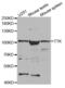 TTK Protein Kinase antibody, abx001944, Abbexa, Western Blot image 