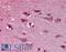 Sprouty Related EVH1 Domain Containing 1 antibody, LS-B3845, Lifespan Biosciences, Immunohistochemistry frozen image 