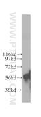 Cytochrome P450 Family 4 Subfamily F Member 11 antibody, 12286-1-AP, Proteintech Group, Western Blot image 