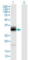 Proenkephalin-A antibody, LS-C197873, Lifespan Biosciences, Western Blot image 