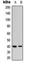 Mitogen-Activated Protein Kinase Kinase 3 antibody, orb315593, Biorbyt, Western Blot image 