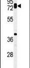 Hyaluronan Synthase 1 antibody, PA5-24853, Invitrogen Antibodies, Western Blot image 