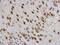 TAR DNA Binding Protein antibody, GTX100579, GeneTex, Immunohistochemistry paraffin image 