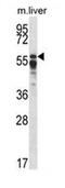 Protein Phosphatase 2 Regulatory Subunit B'Alpha antibody, AP53420PU-N, Origene, Western Blot image 