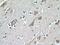 Low Density Lipoprotein Receptor antibody, 10785-1-AP, Proteintech Group, Immunohistochemistry paraffin image 