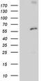 Proteasome 26S Subunit, Non-ATPase 3 antibody, TA504303, Origene, Western Blot image 