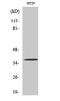 Olfactory Receptor Family 51 Subfamily B Member 2 (Gene/Pseudogene) antibody, A15871, Boster Biological Technology, Western Blot image 