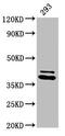 Proteasome 26S Subunit, Non-ATPase 7 antibody, CSB-PA018912LA01HU, Cusabio, Western Blot image 