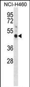 G Protein-Coupled Estrogen Receptor 1 antibody, PA5-71928, Invitrogen Antibodies, Western Blot image 