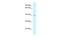 Cysteine Rich With EGF Like Domains 2 antibody, A08616, Boster Biological Technology, Western Blot image 