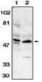 Death Associated Protein Kinase 3 antibody, MBS395661, MyBioSource, Western Blot image 