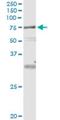 VPS18 Core Subunit Of CORVET And HOPS Complexes antibody, H00057617-M04, Novus Biologicals, Immunoprecipitation image 