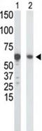 Glucokinase antibody, GTX59598, GeneTex, Western Blot image 