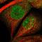 C2CD2 Like antibody, HPA011044, Atlas Antibodies, Immunofluorescence image 