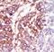 Casein Kinase 1 Gamma 3 antibody, LS-C100602, Lifespan Biosciences, Immunohistochemistry paraffin image 
