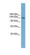 DCC Netrin 1 Receptor antibody, NBP1-56988, Novus Biologicals, Western Blot image 