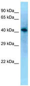Vesicle Amine Transport 1 Like antibody, TA344752, Origene, Western Blot image 